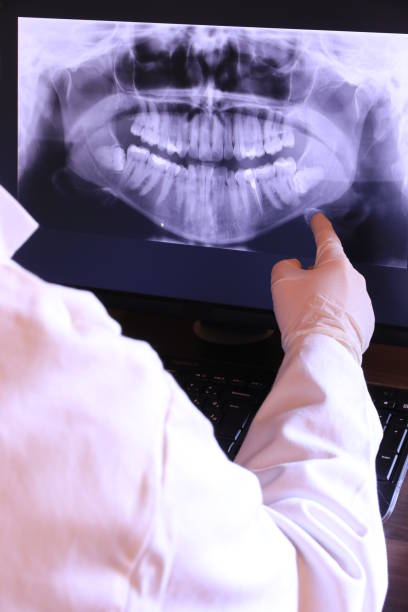 Best Emergency Treatment for Oral Infections in Mayflower Village, CA